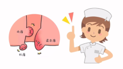 十堰东大肛肠医院：肛门旁边长肉疙瘩能自愈吗？