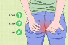 呼和浩特东大肛肠医院：肛周脓肿来临前的“ 信号 ”