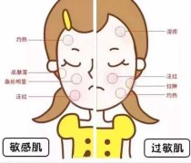 沈阳治过敏性皮炎医院哪家比较好？更专业？