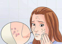 沈阳脸上有疤痕怎么办？去哪去除？	