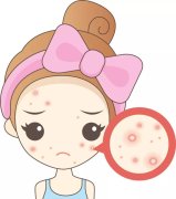 在沈阳哪个医院看痘痘痤疮好？沈阳肤康怎么样？